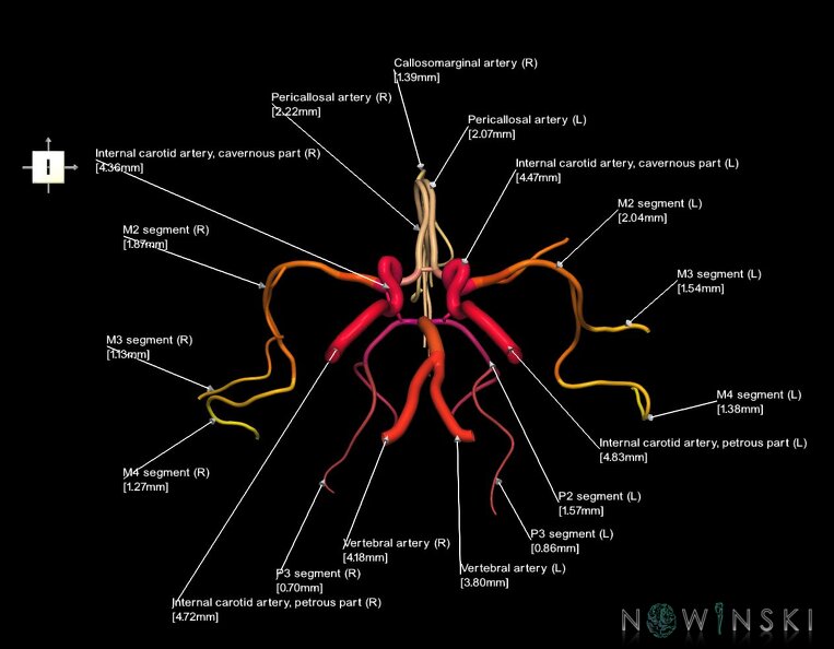 G1.T15.1.V6.C2.L3.Intracranial_arterial_system_main_branches.tiff