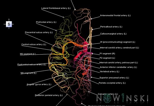 G1.T15.3.V5.C2.L1.Intracranial arterial system left