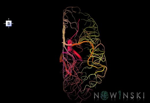 G1.T15.4.V5.C2.L0.Intracranial arterial system right