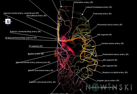 G1.T15.4.V5.C2.L1.Intracranial arterial system right