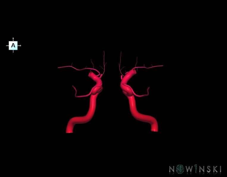 G1.T15.7.V1.C2.L0.Internal_carotid_artery.tiff