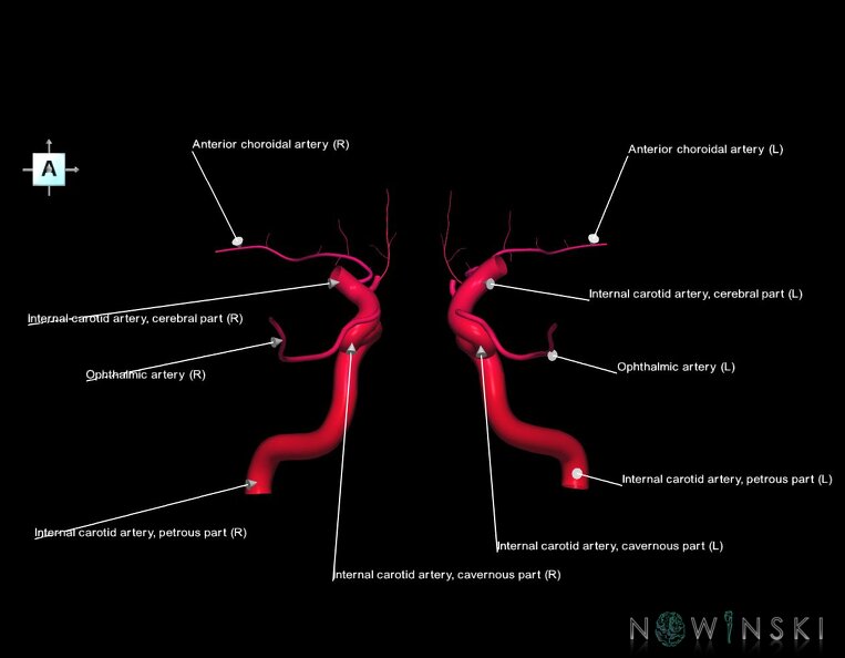 G1.T15.7.V1.C2.L1.Internal_carotid_artery.tiff