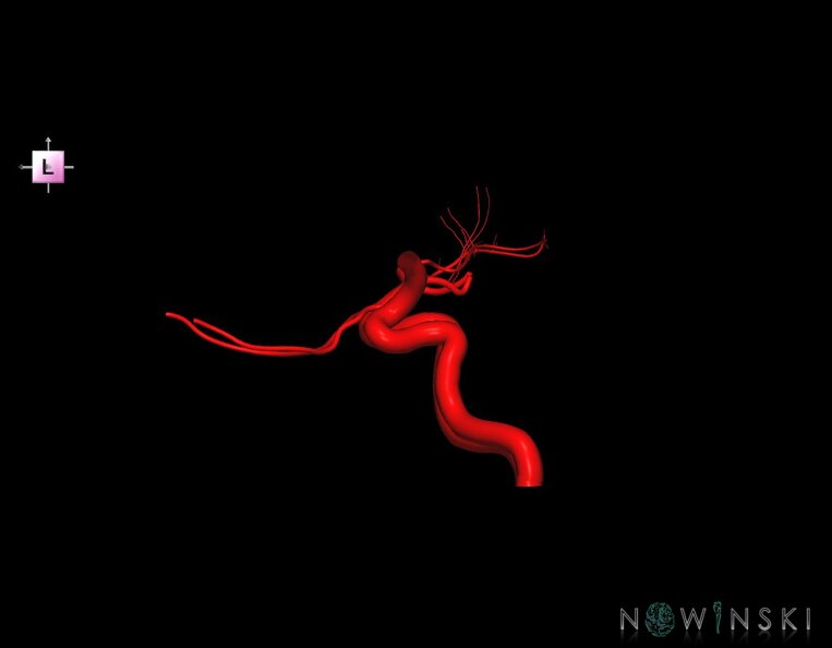 G1.T15.7.V2.C1.L0.Internal_carotid_artery.tiff