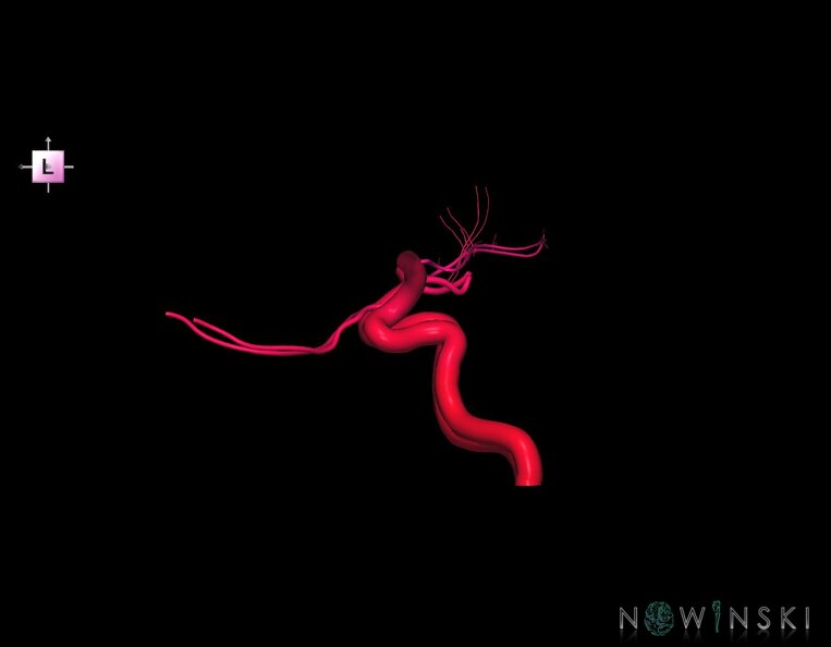 G1.T15.7.V2.C2.L0.Internal_carotid_artery.tiff