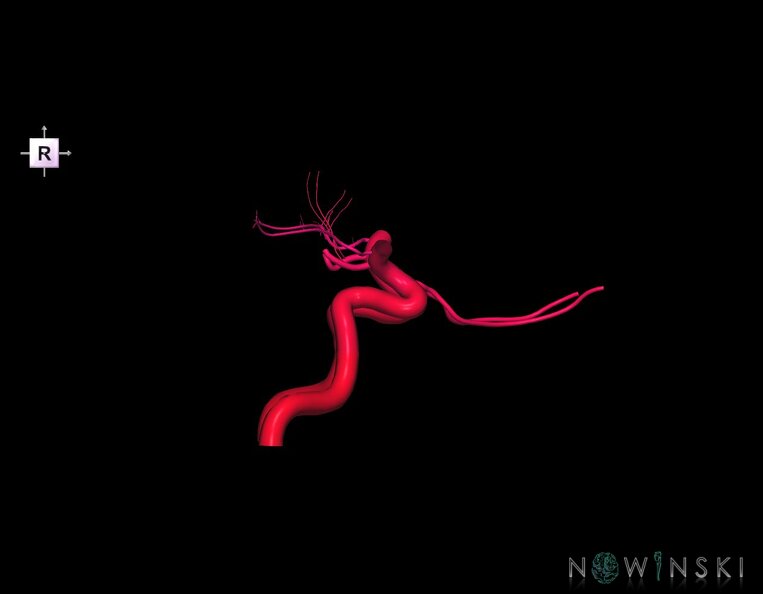 G1.T15.7.V4.C2.L0.Internal_carotid_artery.tiff