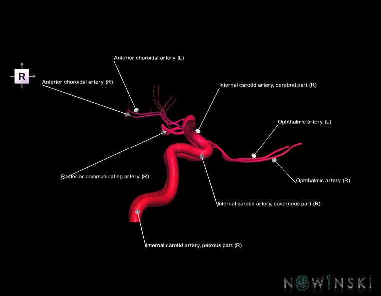 G1.T15.7.V4.C2.L1.Internal_carotid_artery.tiff