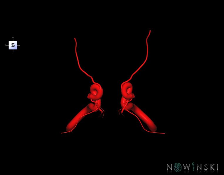 G1.T15.7.V5.C1.L0.Internal_carotid_artery.tiff