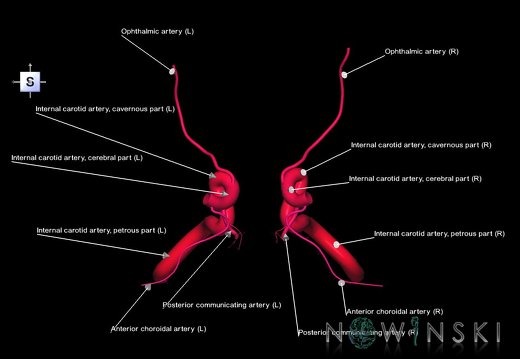 G1.T15.7.V5.C2.L1.Internal carotid artery