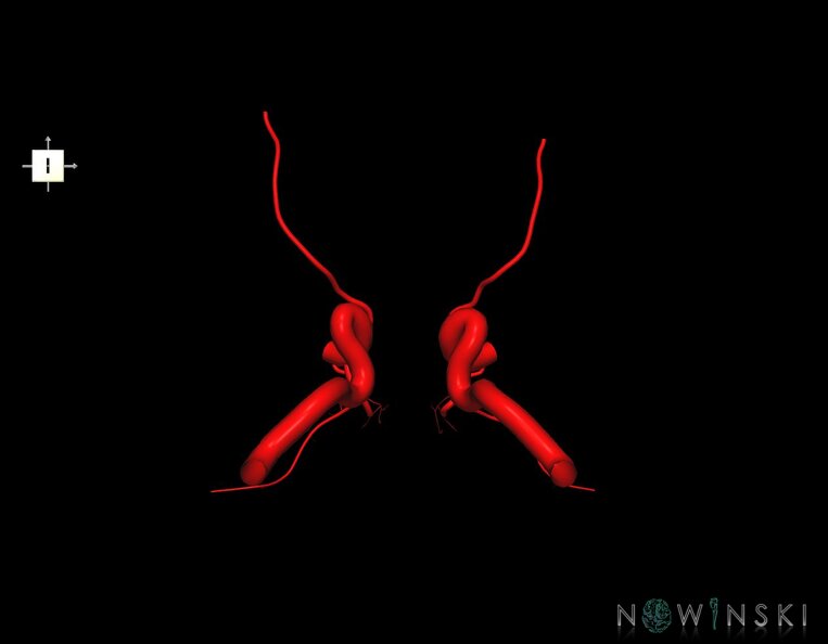 G1.T15.7.V6.C1.L0.Internal_carotid_artery.tiff
