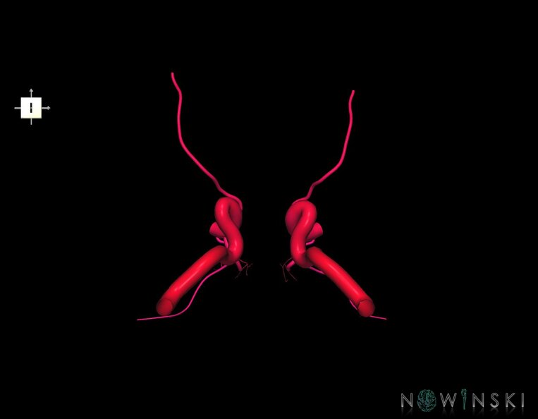 G1.T15.7.V6.C2.L0.Internal_carotid_artery.tiff