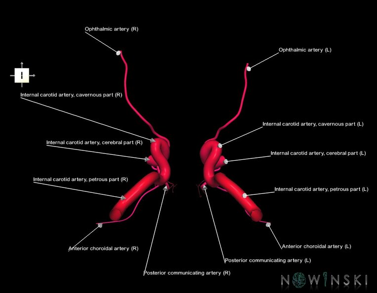 G1.T15.7.V6.C2.L1.Internal_carotid_artery.tiff