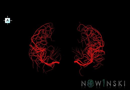G1.T15.8.V1.C1.L0.Middle cerebral artery