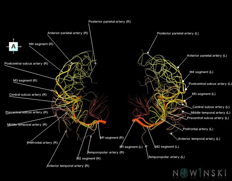 G1.T15.8.V1.C2.L1.Middle_cerebral_artery.tiff