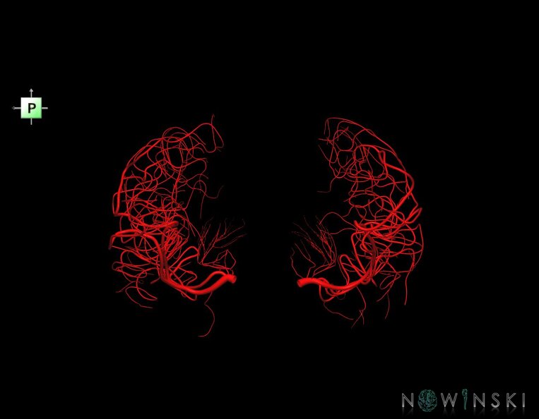 G1.T15.8.V3.C1.L0.Middle_cerebral_artery.tiff