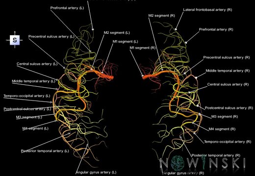 G1.T15.8.V5.C2.L1.Middle cerebral artery