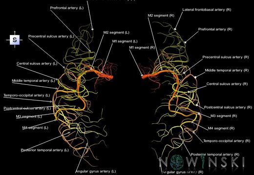 G1.T15.8.V5.C2.L1.Middle cerebral artery