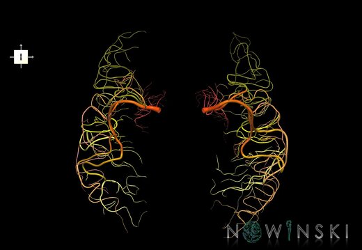 G1.T15.8.V6.C2.L0.Middle cerebral artery