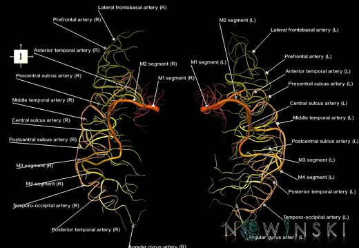 G1.T15.8.V6.C2.L1.Middle cerebral artery