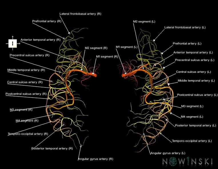 G1.T15.8.V6.C2.L1.Middle_cerebral_artery.tiff