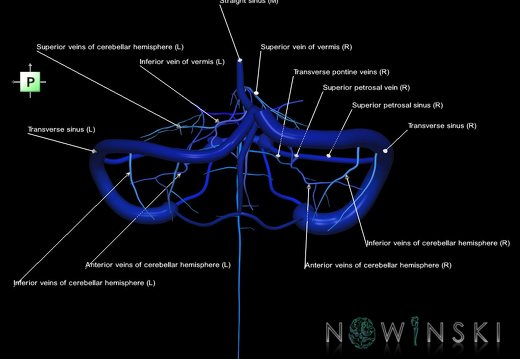 G1.T16.10.V3.C2.L1.Dural sinuses-Posterior fossa veins