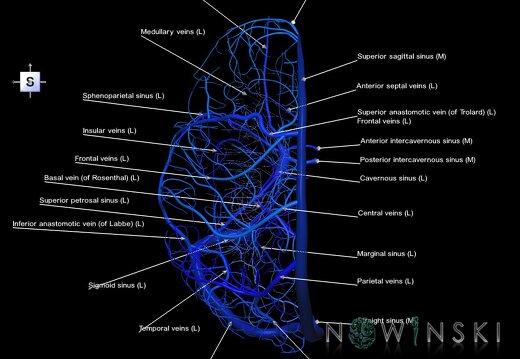 G1.T16.2.V5.C2.L1.Intracranial venous system left