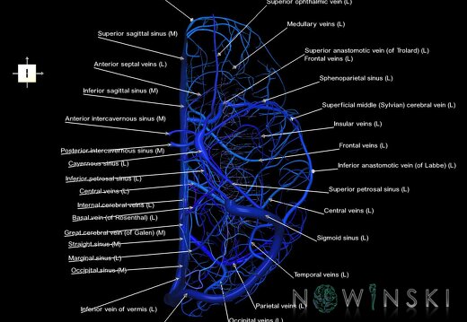 G1.T16.2.V6.C2.L1.Intracranial venous system left