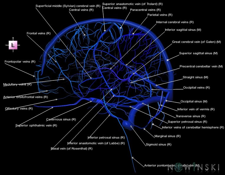 G1.T16.3.V2.C2.L1.Intracranial_venous_system_right.tiff