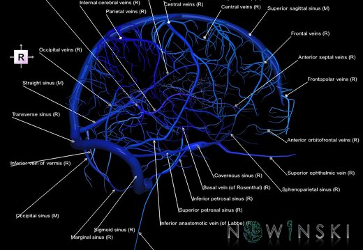 G1.T16.3.V4.C2.L1.Intracranial venous system right
