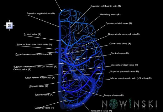 G1.T16.3.V5.C2.L1.Intracranial venous system right