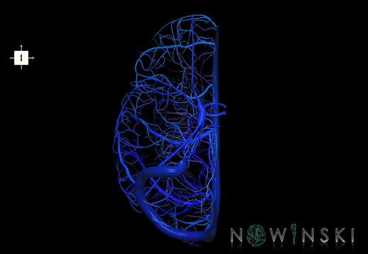 G1.T16.3.V6.C2.L0.Intracranial venous system right