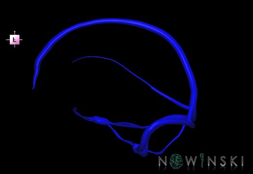 G1.T16.4.V2.C1.L0.Dural sinuses