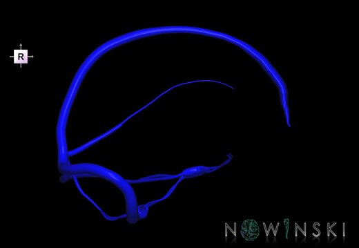 G1.T16.4.V4.C1.L0.Dural sinuses