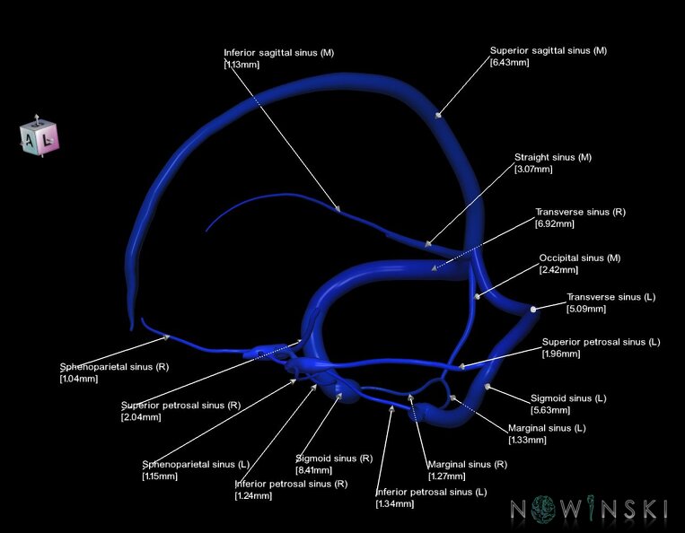 G1.T16.4.V7.C2.L3.Dural_sinuses.tiff