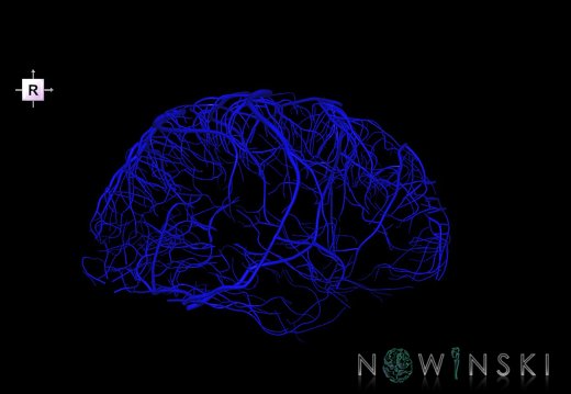 G1.T16.5.V4.C1.L0.Superficial cerebral veins