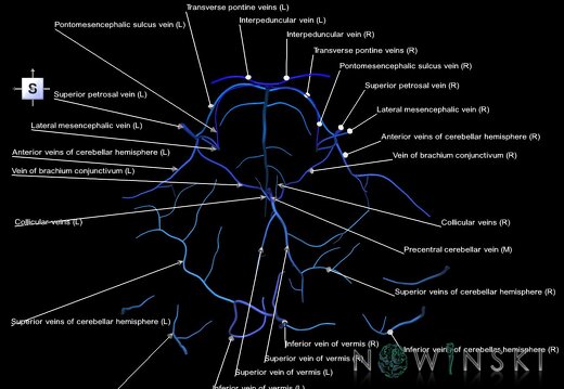 G1.T16.7.V5.C2.L1.Posterior fossa veins