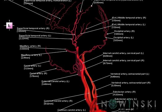 G1.T17.1.V2.C2.L3.Extracranial arteries main branches