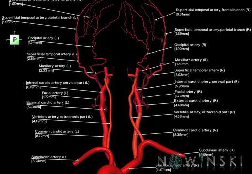 G1.T17.1.V3.C2.L3.Extracranial arteries main branches