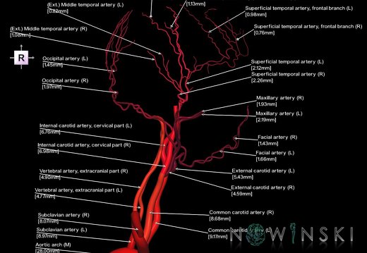 G1.T17.1.V4.C2.L3.Extracranial arteries main branches
