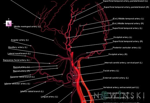 G1.T17.2.V2.C2.L1.Extracranial arteries all