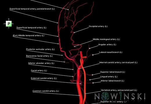G1.T17.3.V3.C2.L1.Extracranial arteries left