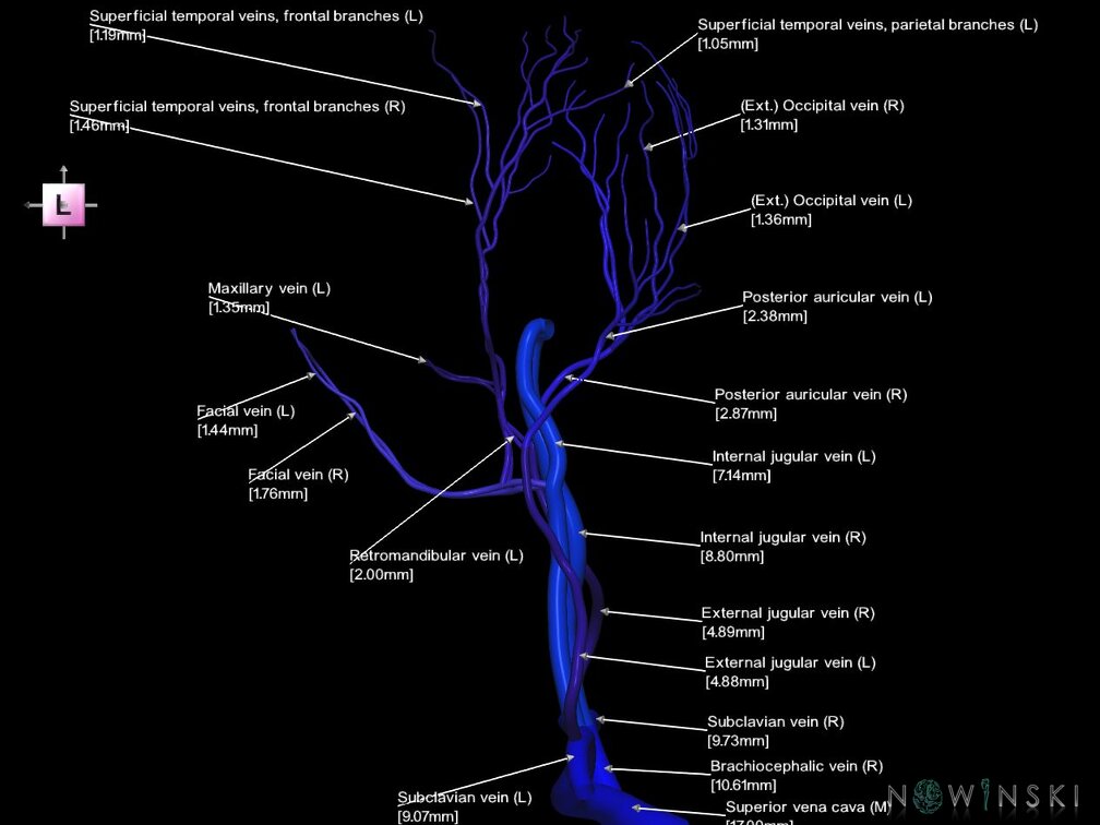 G1.T18.1.V2.C2.L3.Extracranial veins main branches