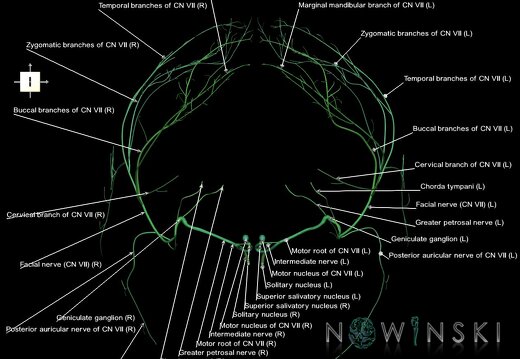 G1.T19.10.V6.C2.L1.Facial nerve