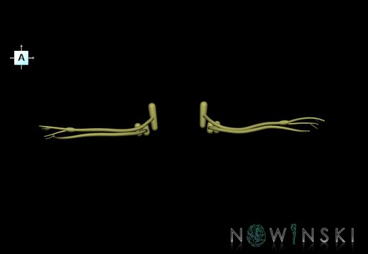 G1.T19.11.V1.C1.L0.Vestibulocochlear nerve
