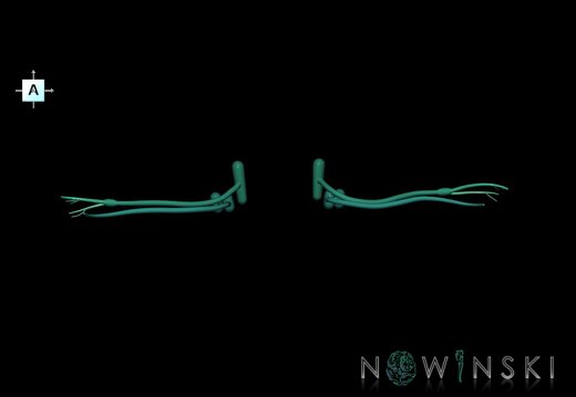 G1.T19.11.V1.C2.L0.Vestibulocochlear nerve