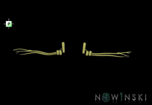 G1.T19.11.V3.C1.L0.Vestibulocochlear nerve