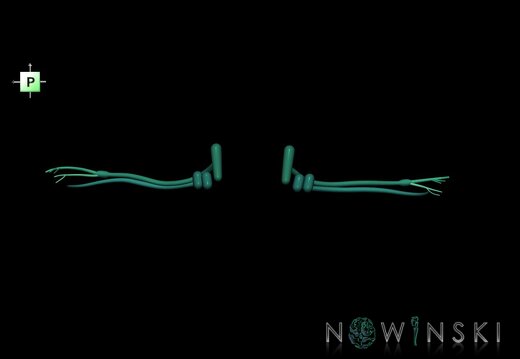 G1.T19.11.V3.C2.L0.Vestibulocochlear nerve