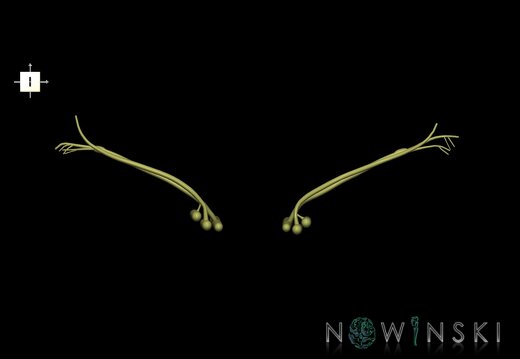 G1.T19.11.V6.C1.L0.Vestibulocochlear nerve