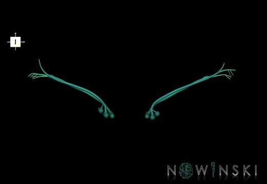 G1.T19.11.V6.C2.L0.Vestibulocochlear nerve