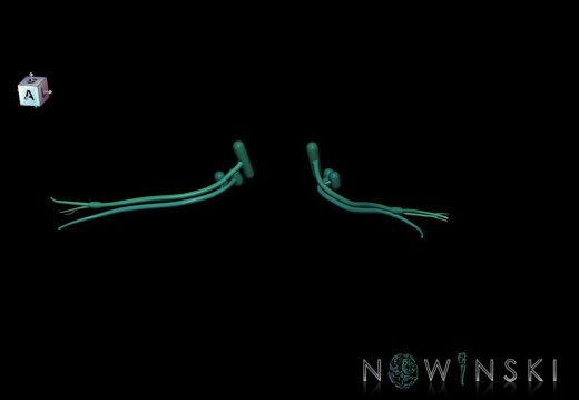 G1.T19.11.V7.C2.L0.Vestibulocochlear nerve