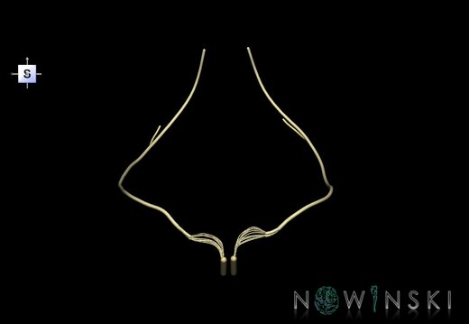 G1.T19.15.V5.C2.L0.Hypoglossal nerve